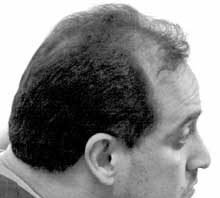 Rapist pleads guilty to attacking four women