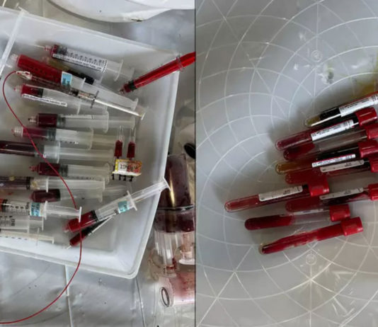 Santa Clara County hospitals investigated for illegal medical, hazardous waste disposal