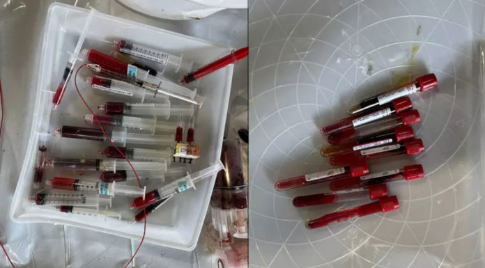 Santa Clara County hospitals investigated for illegal medical, hazardous waste disposal